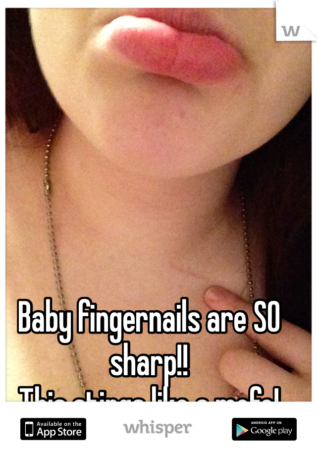 Baby fingernails are SO sharp!!
This stings like a mofo!
