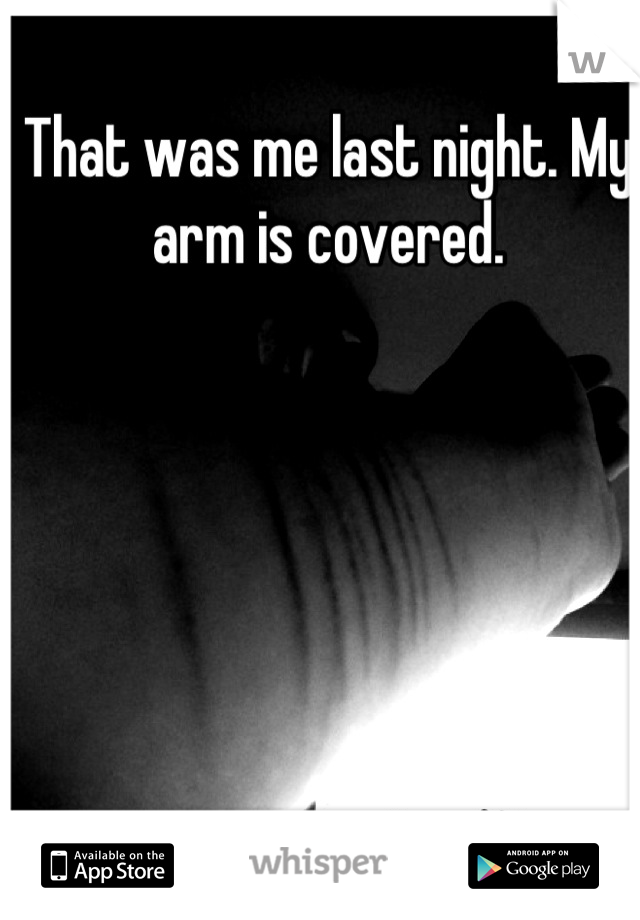 That was me last night. My arm is covered.