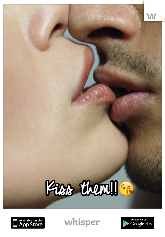 Kiss them!!😘
