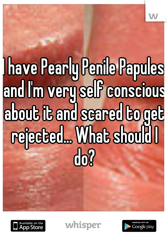 I have Pearly Penile Papules and I'm very self conscious about it and scared to get rejected... What should I do?