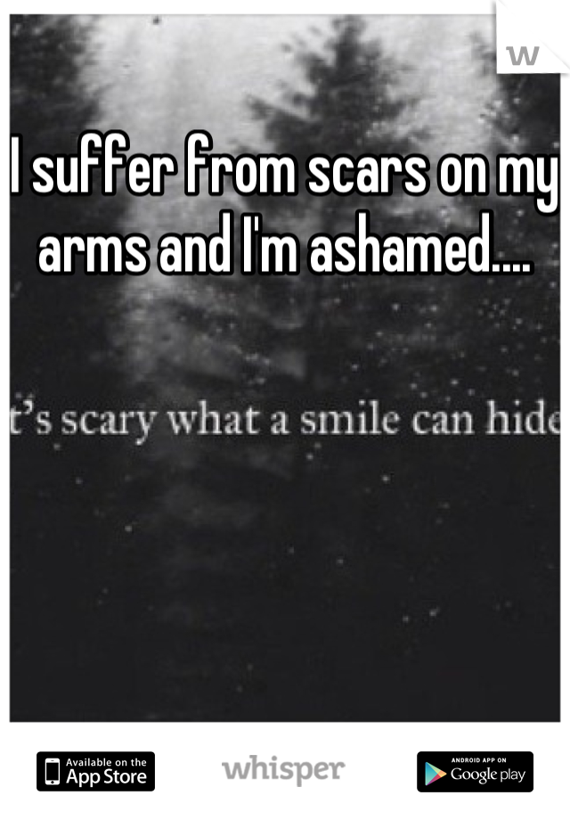 I suffer from scars on my arms and I'm ashamed....
