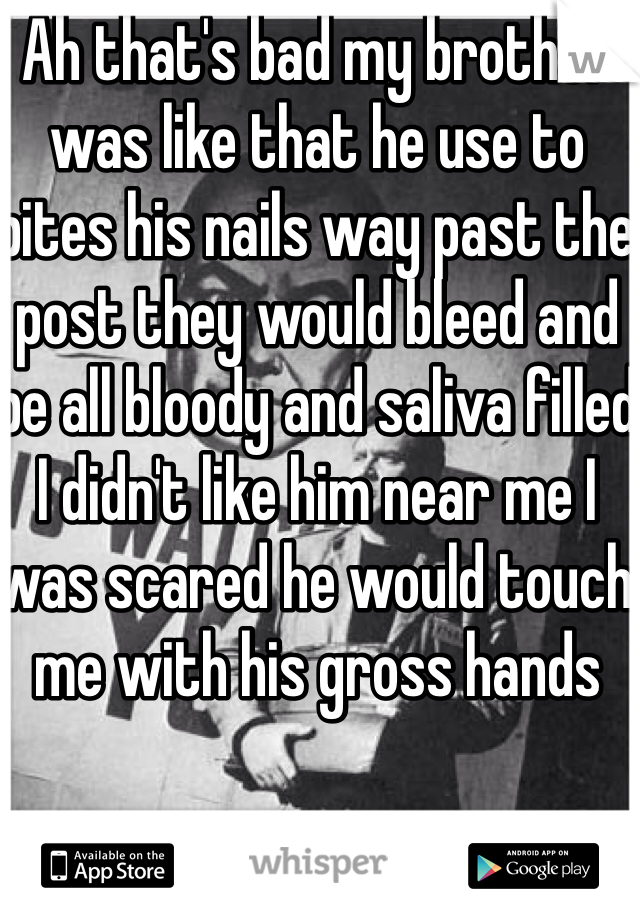 Ah that's bad my brother was like that he use to bites his nails way past the post they would bleed and be all bloody and saliva filled I didn't like him near me I was scared he would touch me with his gross hands