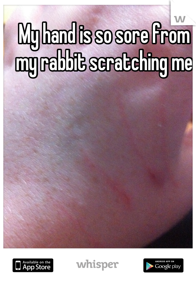 My hand is so sore from my rabbit scratching me