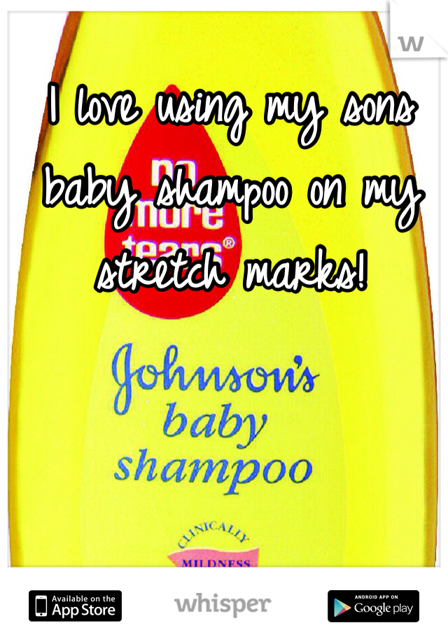 I love using my sons baby shampoo on my stretch marks!
