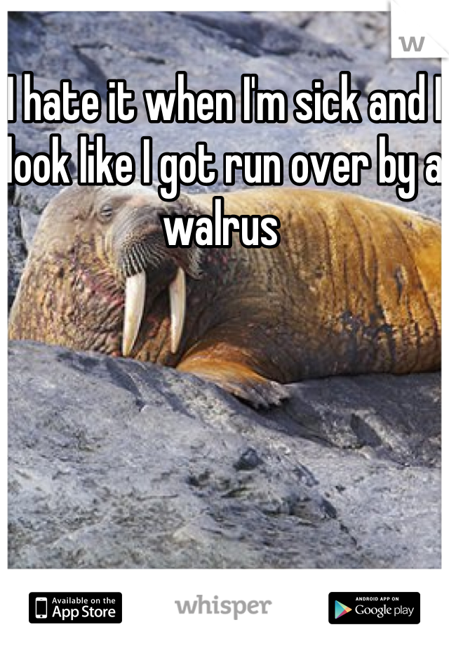 I hate it when I'm sick and I look like I got run over by a walrus 