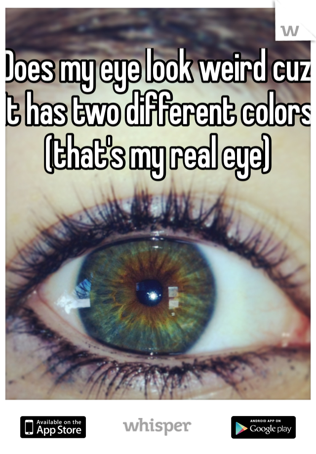 Does my eye look weird cuz It has two different colors (that's my real eye)