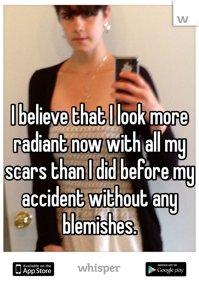 I believe that I look more radiant now with all my scars than I did before my accident without any blemishes. 