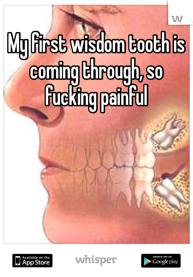My first wisdom tooth is coming through, so fucking painful