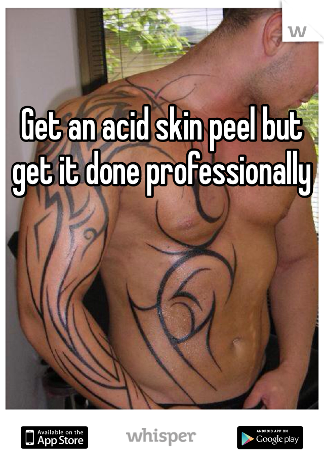 Get an acid skin peel but get it done professionally 
