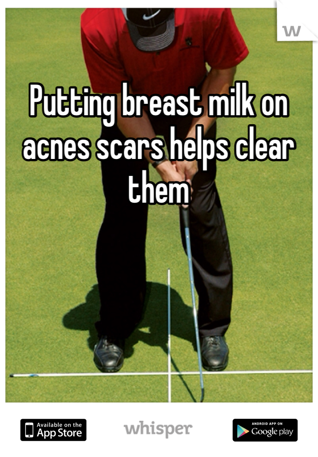 Putting breast milk on acnes scars helps clear them