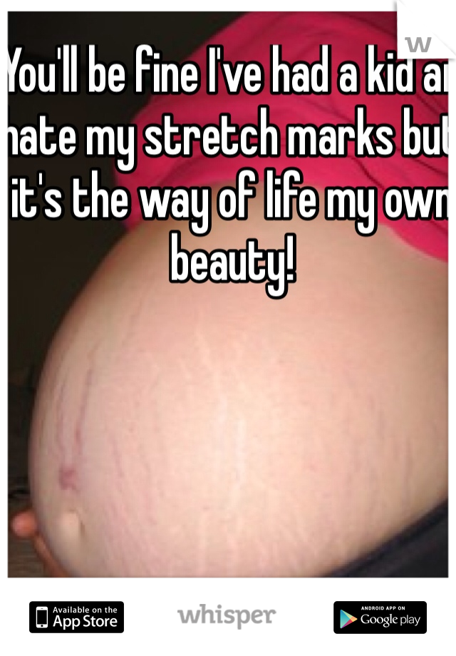 You'll be fine I've had a kid an hate my stretch marks but it's the way of life my own beauty! 