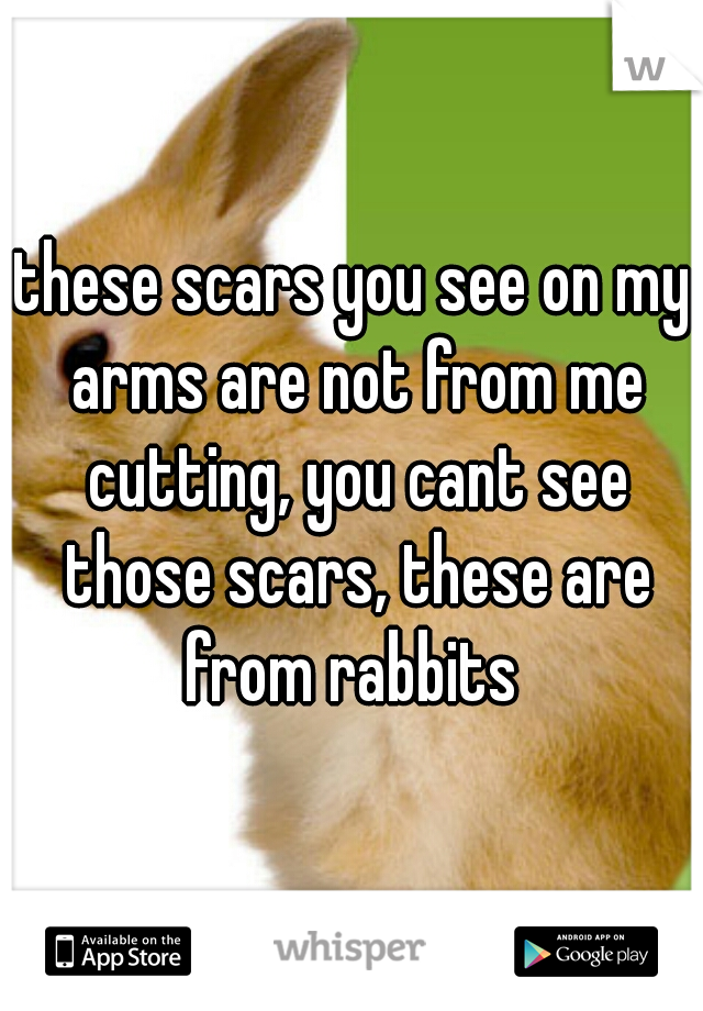 these scars you see on my arms are not from me cutting, you cant see those scars, these are from rabbits 