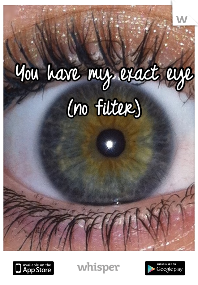 You have my exact eye (no filter)