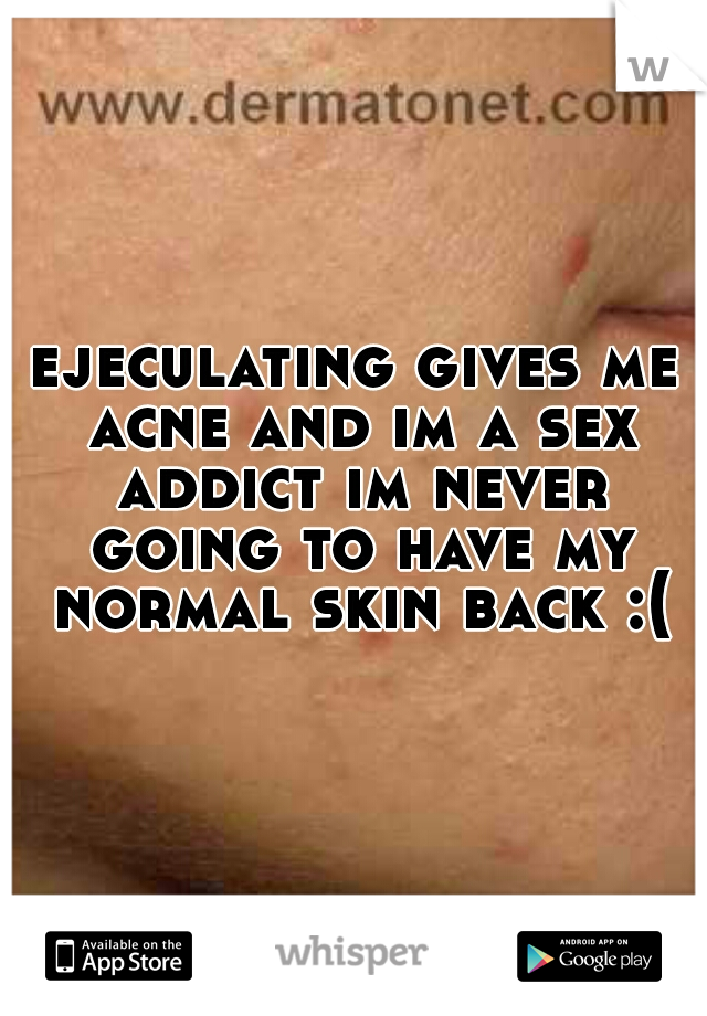 ejeculating gives me acne and im a sex addict im never going to have my normal skin back :(