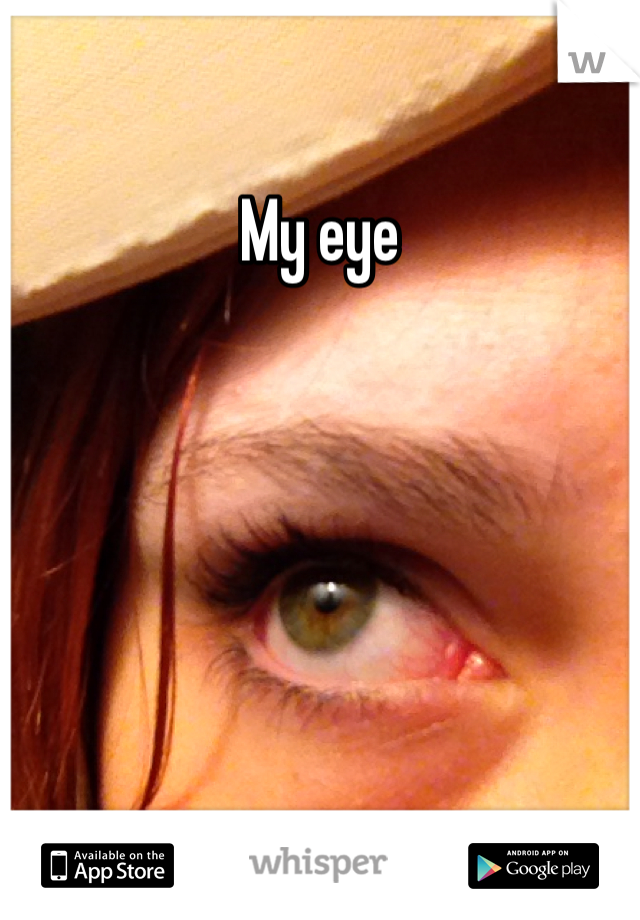 My eye 