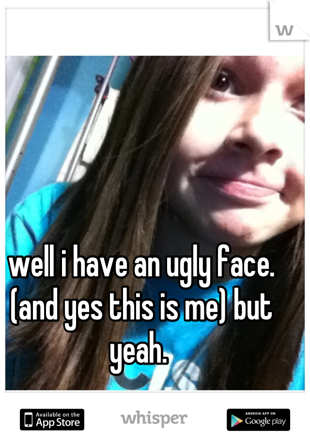 well i have an ugly face. (and yes this is me) but yeah. 