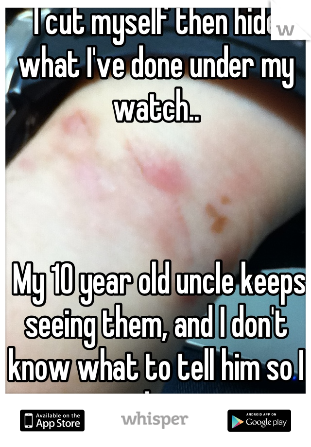 I cut myself then hide what I've done under my watch..



 My 10 year old uncle keeps seeing them, and I don't know what to tell him so I lie