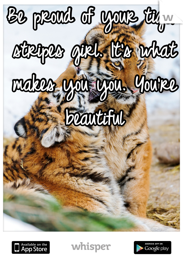 Be proud of your tiger stripes girl. It's what makes you you. You're beautiful 