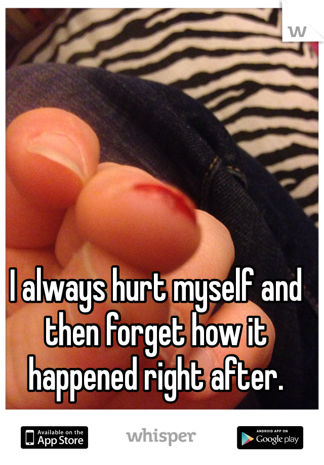 I always hurt myself and then forget how it happened right after. 