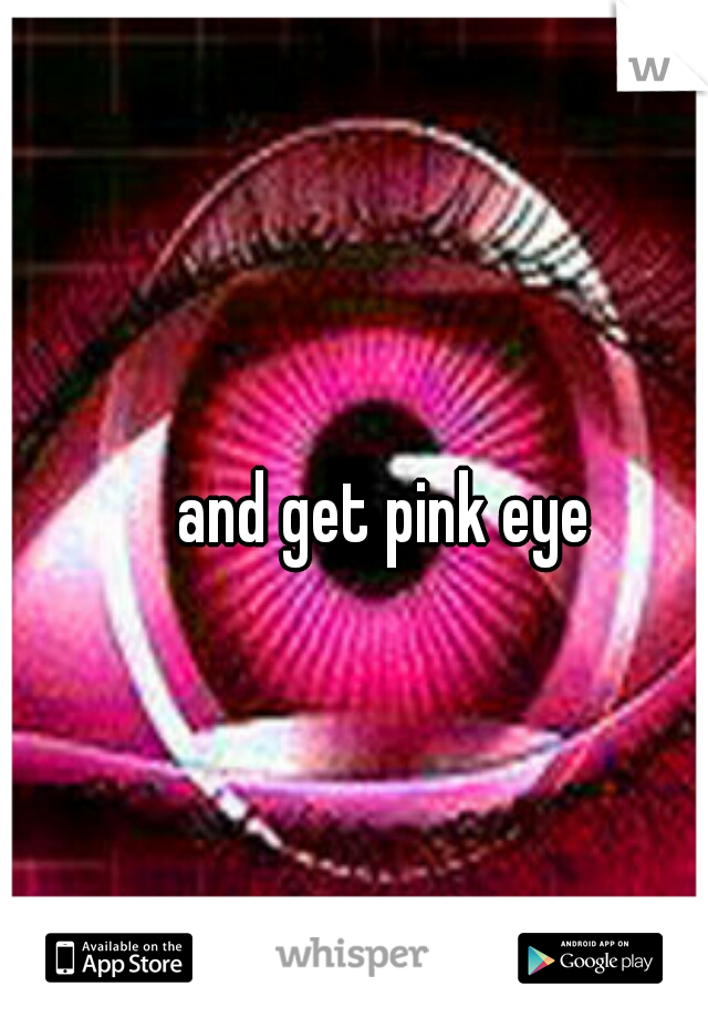 and get pink eye