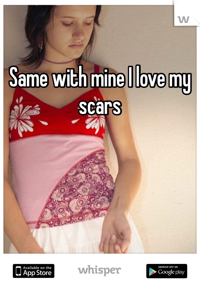 Same with mine I love my scars 