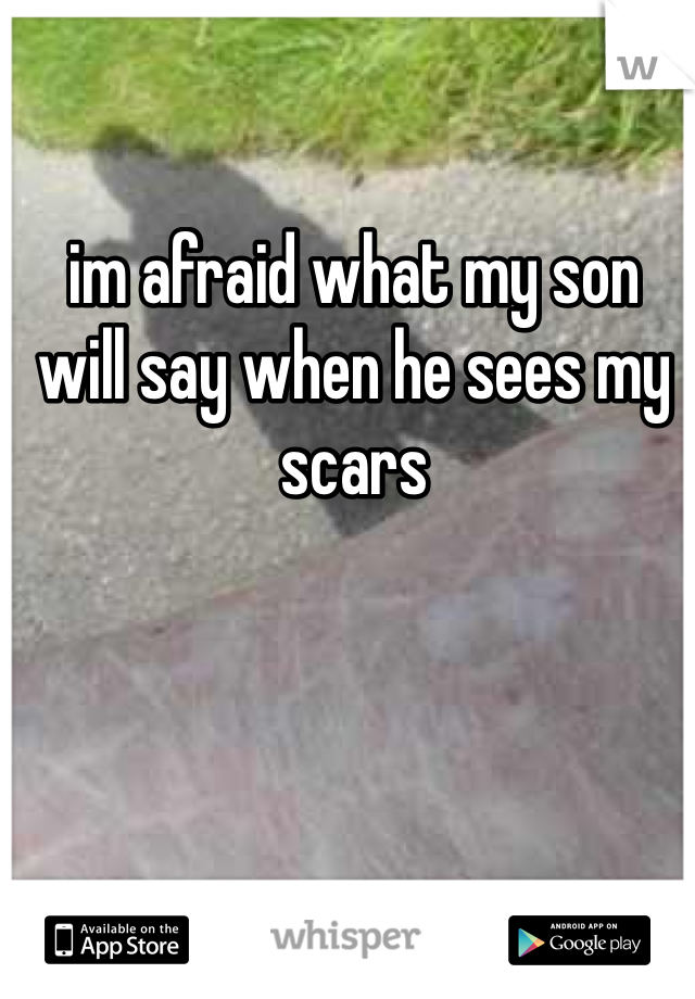 im afraid what my son 
will say when he sees my scars