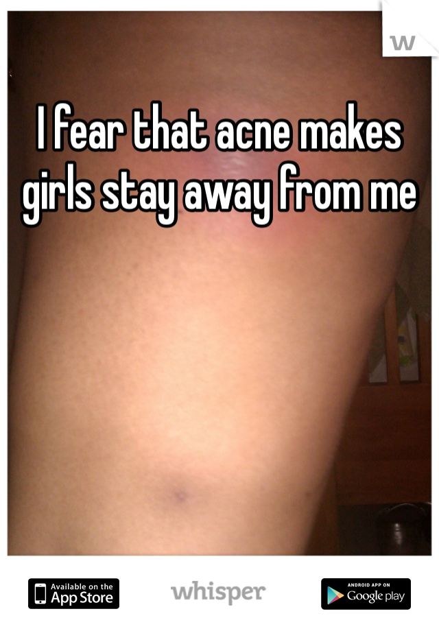 I fear that acne makes girls stay away from me