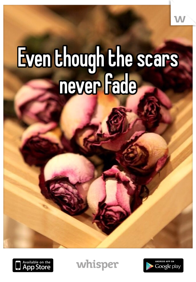 Even though the scars never fade