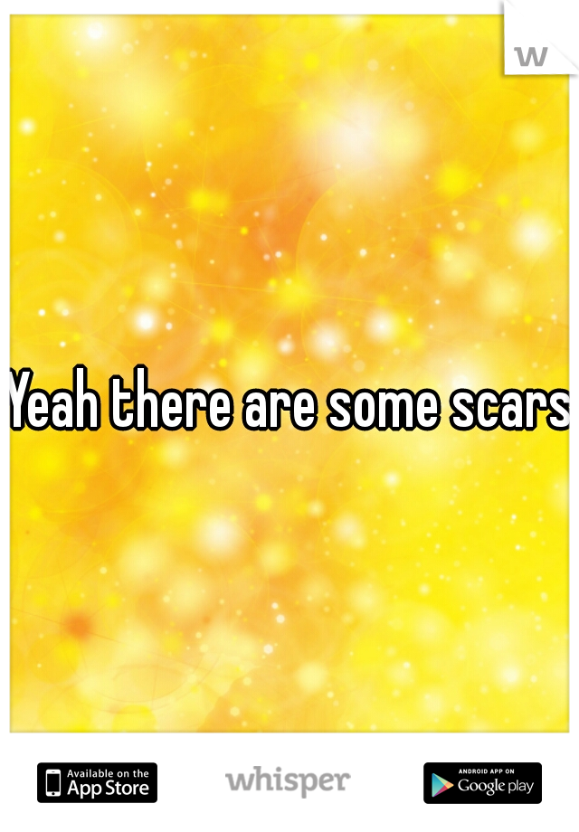 Yeah there are some scars 