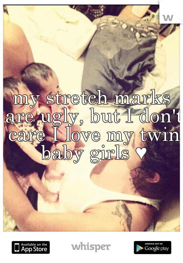 my stretch marks are ugly, but I don't care I love my twin baby girls ♥
