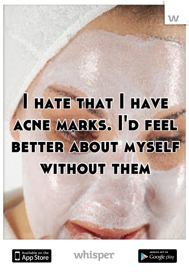 I hate that I have acne marks. I'd feel better about myself without them