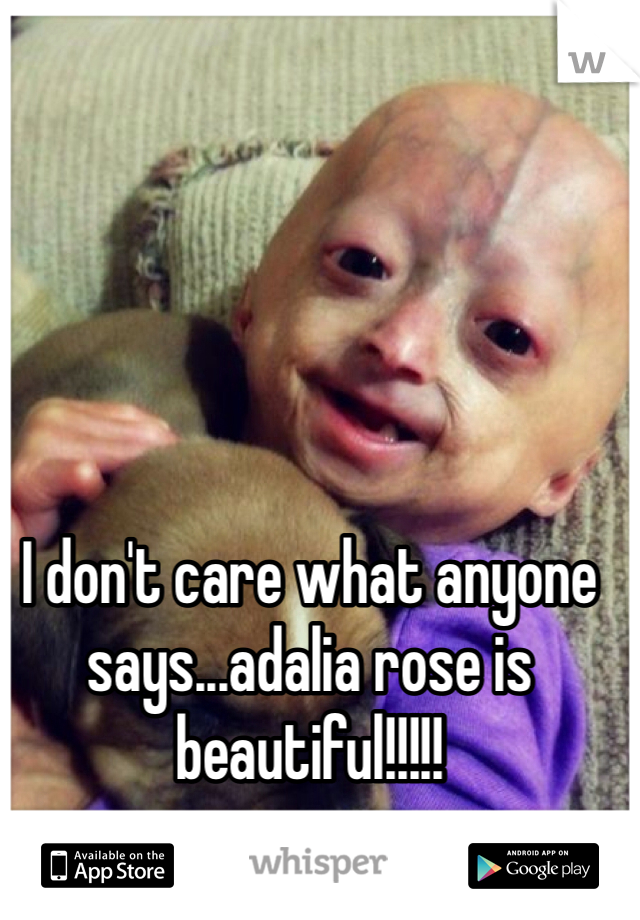I don't care what anyone says...adalia rose is beautiful!!!!! 