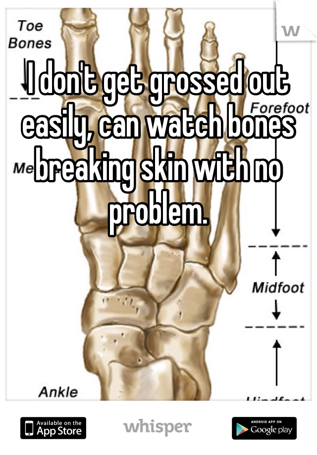 I don't get grossed out easily, can watch bones breaking skin with no problem. 