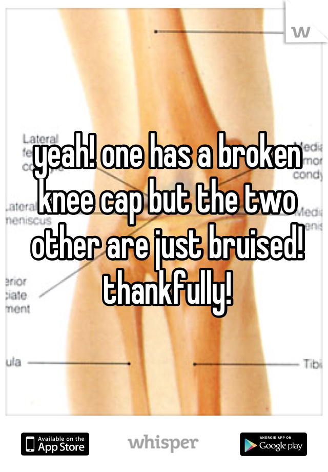 yeah! one has a broken knee cap but the two other are just bruised! thankfully!