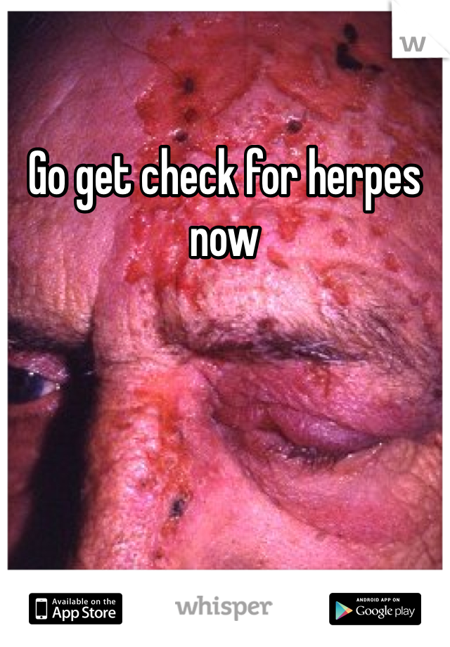 Go get check for herpes now