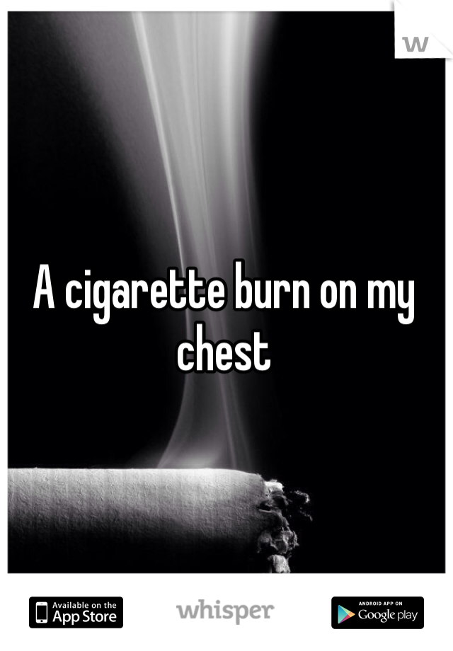 A cigarette burn on my chest