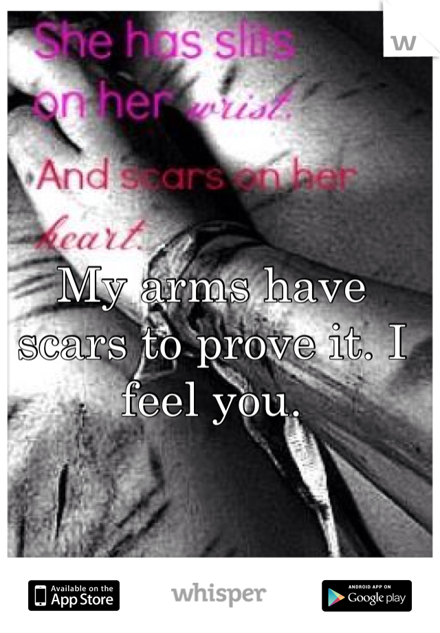 My arms have scars to prove it. I feel you. 