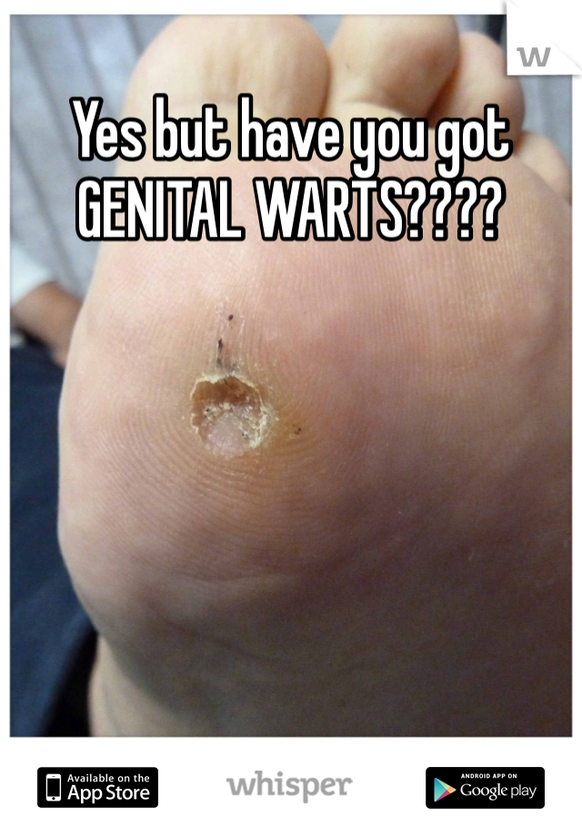 Yes but have you got GENITAL WARTS????

