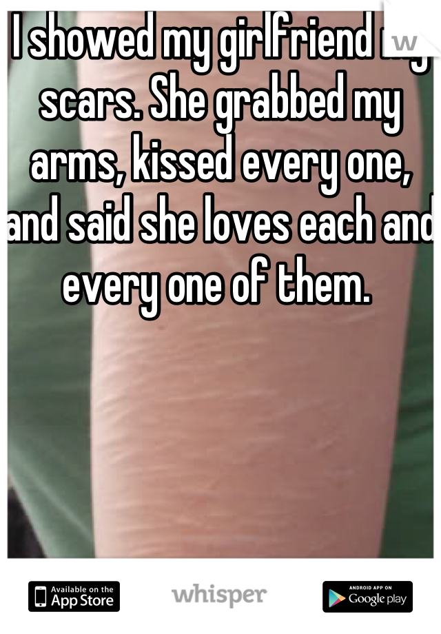 I showed my girlfriend my scars. She grabbed my arms, kissed every one, and said she loves each and every one of them. 