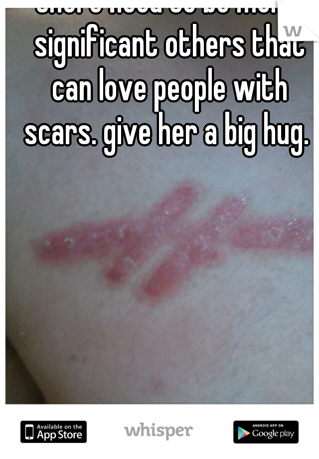 there need to be more significant others that can love people with scars. give her a big hug. 