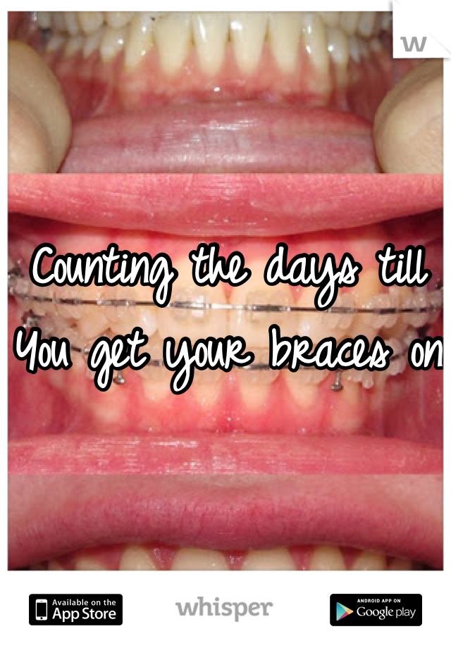 Counting the days till
You get your braces on
