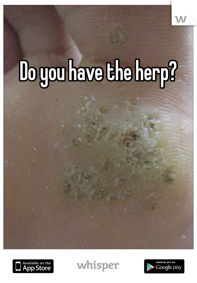 Do you have the herp?