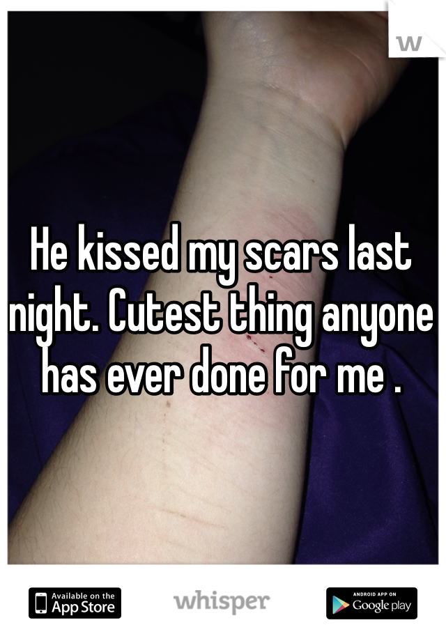 He kissed my scars last night. Cutest thing anyone has ever done for me . 