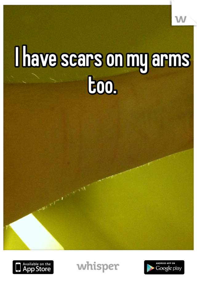 I have scars on my arms too.