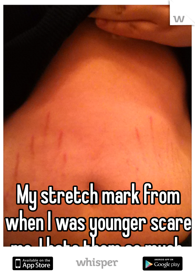 My stretch mark from when I was younger scare me. I hate them so much. 