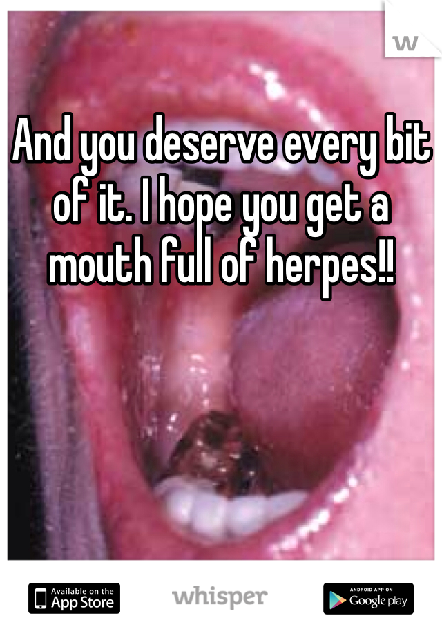 And you deserve every bit of it. I hope you get a mouth full of herpes!!