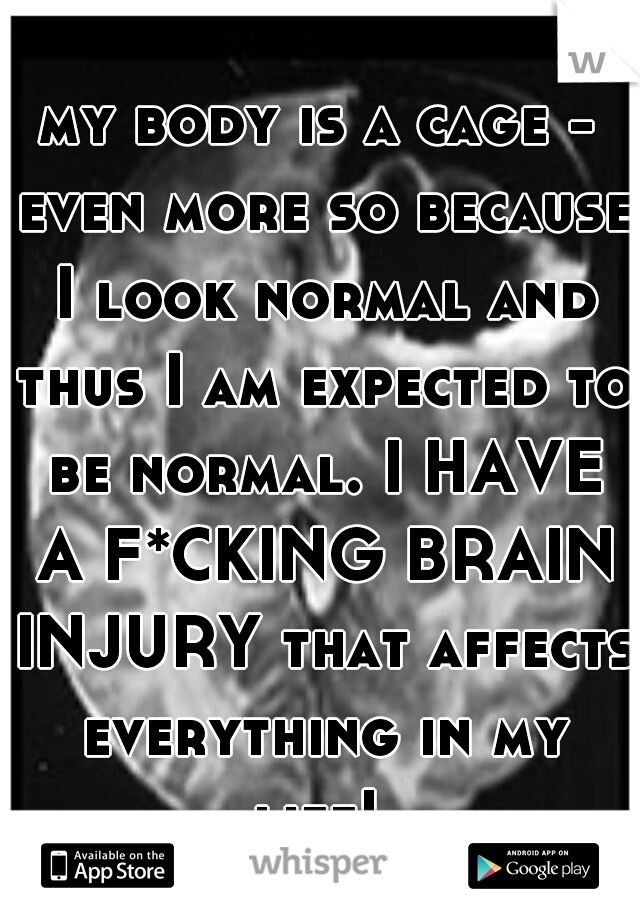 my body is a cage - even more so because I look normal and thus I am expected to be normal. I HAVE A F*CKING BRAIN INJURY that affects everything in my life! 