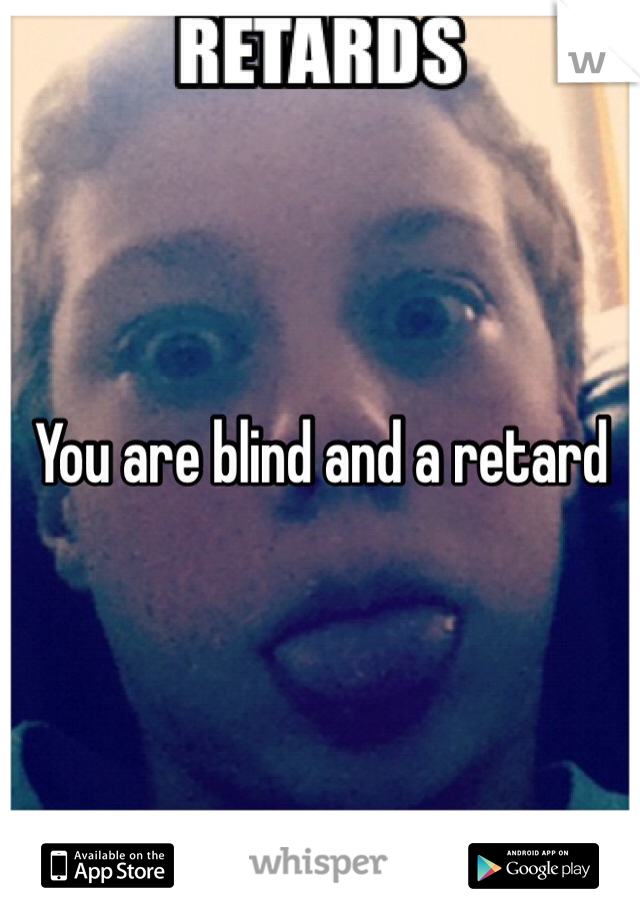 You are blind and a retard