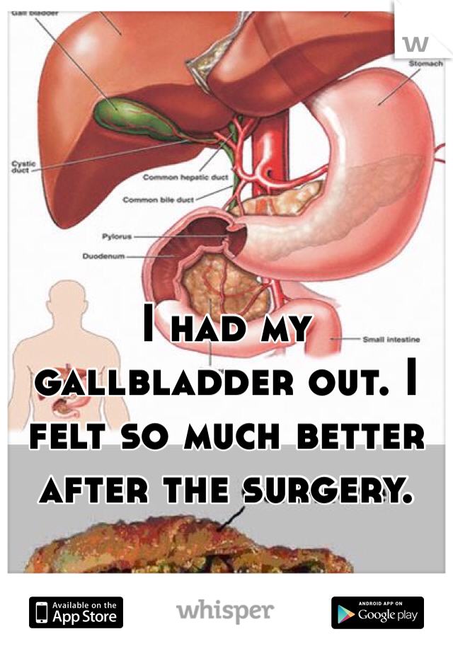 I had my gallbladder out. I felt so much better after the surgery. 