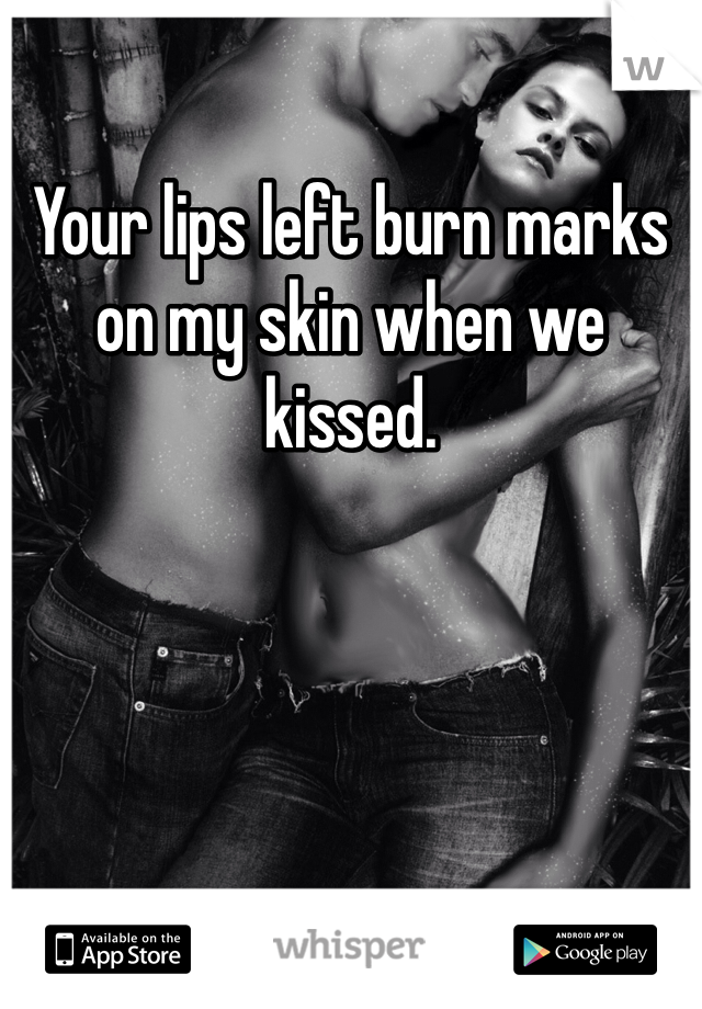 Your lips left burn marks on my skin when we kissed.